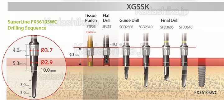 Dentium XGSSK デジタルガイド手術キット（シンプルキット）