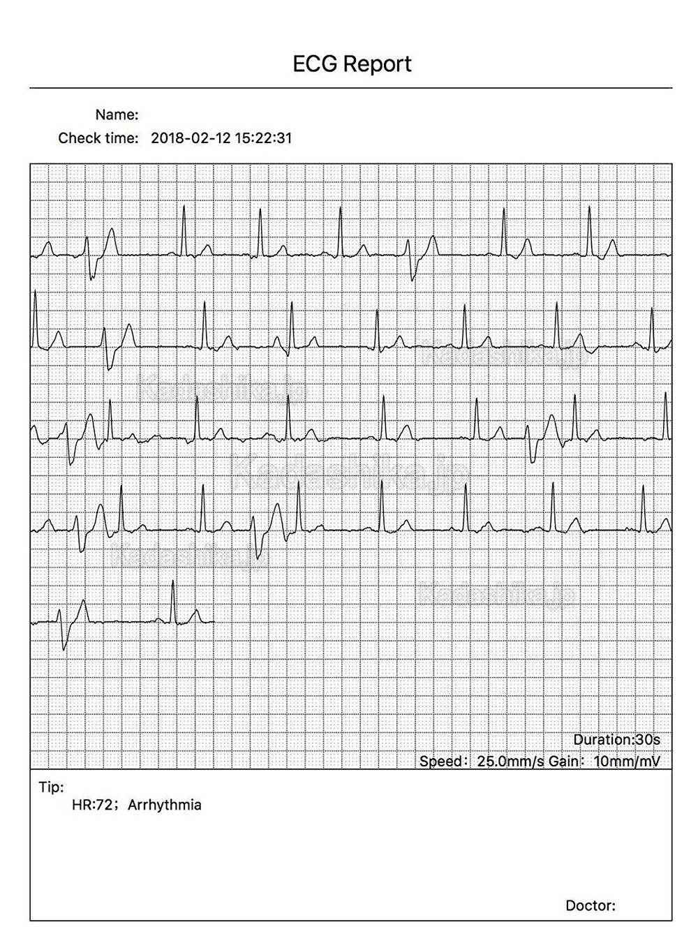 CONTEC PM10 家庭用 携帯型 心電計 ECG/EKGモニター