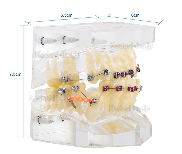 歯科透明製矯正治療顎模型 ブラケット・チェーン・ワイヤー付き
